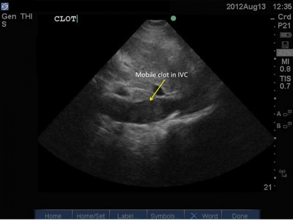 Case of the Month #3 – Answer – Western Sono