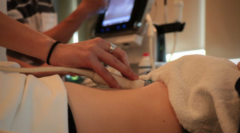 ultrasound session photo