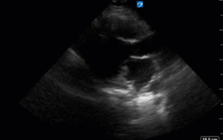 ultra sound gif